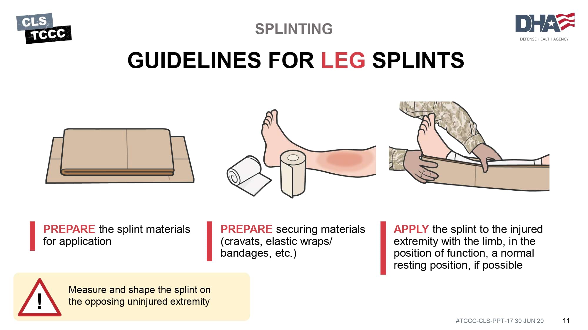 module-17-fractures-splinting-slide-11