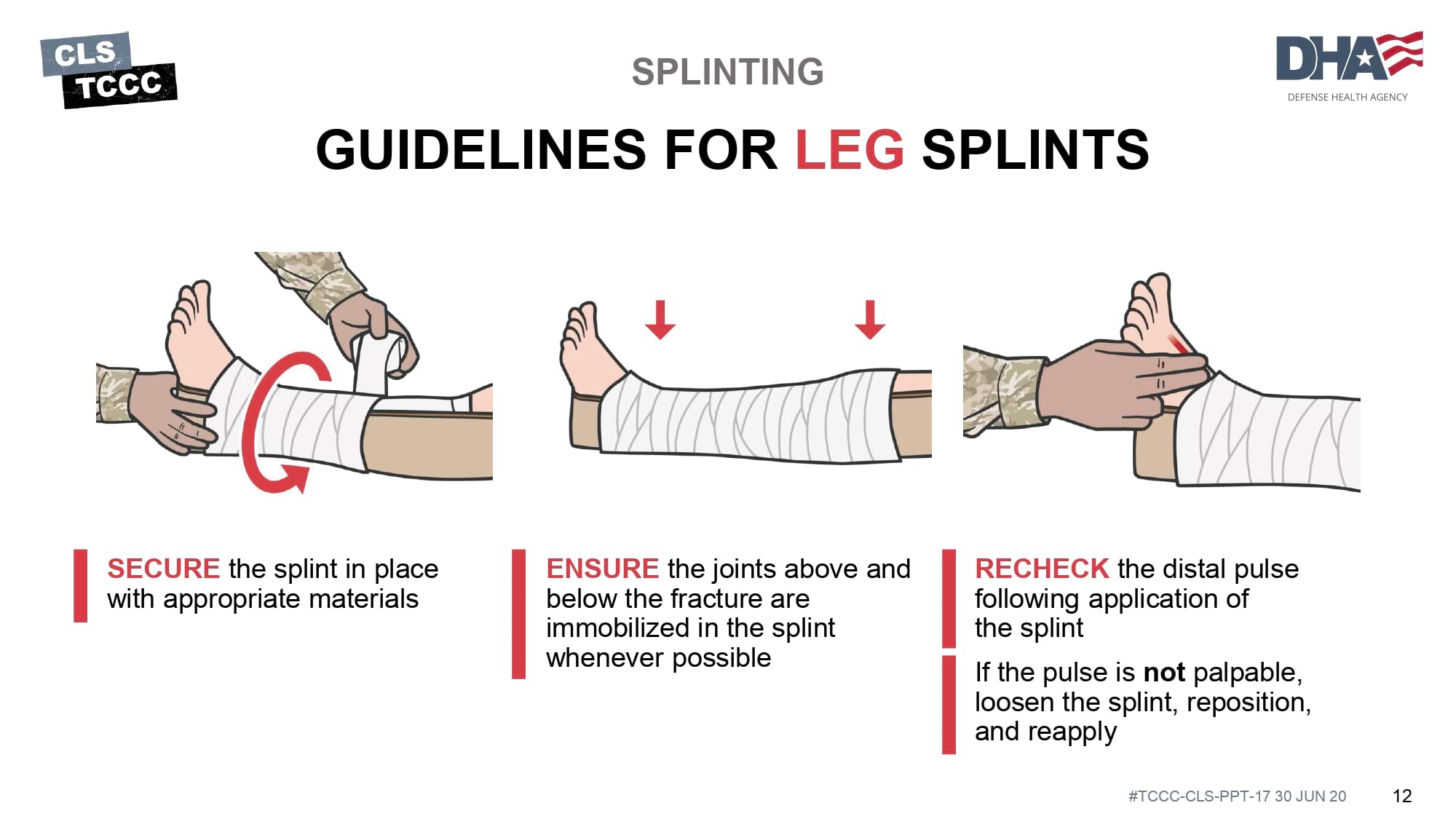 module-17-fractures-splinting-slide-12