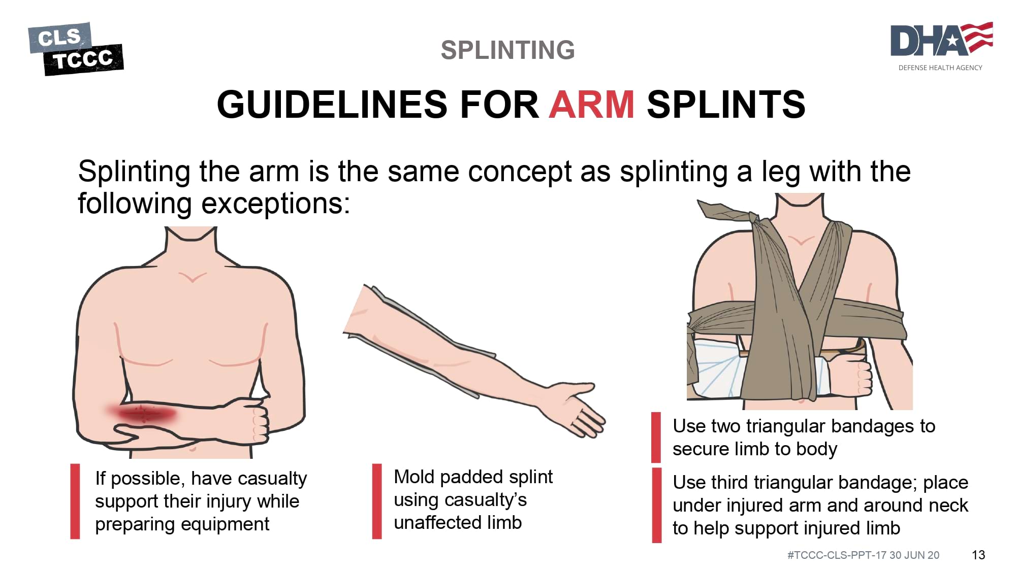 module-17-fractures-splinting-slide-13