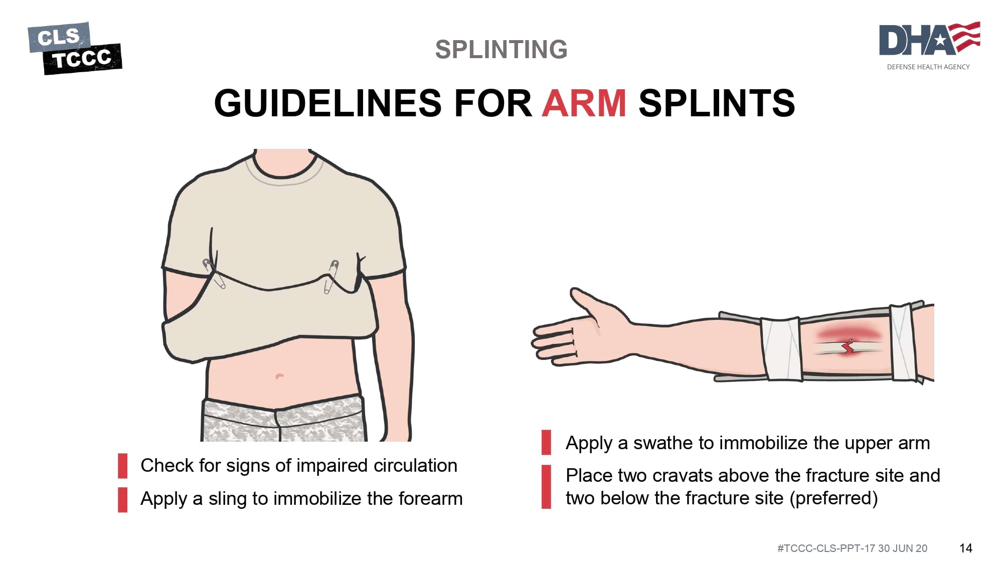 module-17-fractures-splinting-slide-14