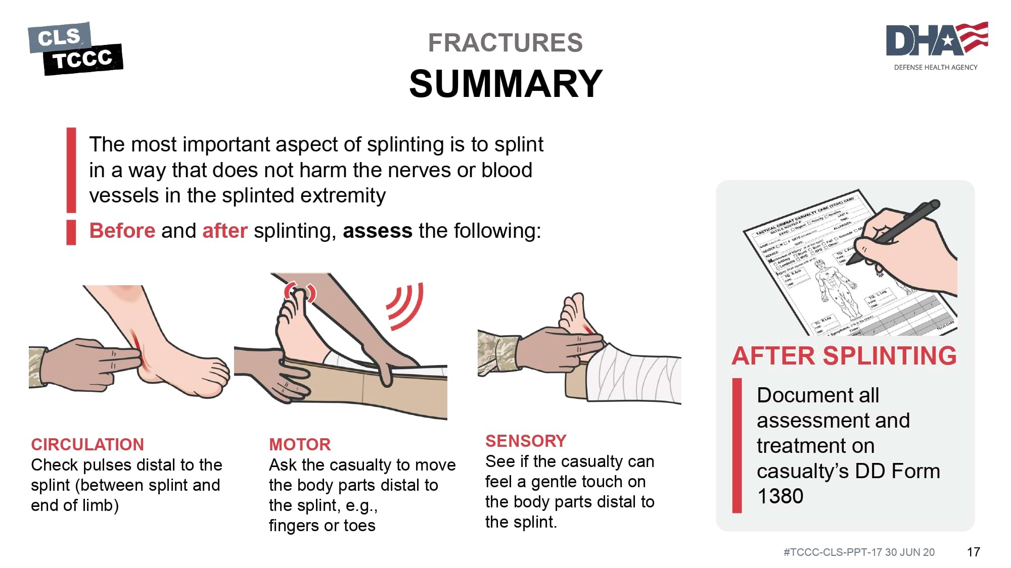 module-17-fractures-splinting-slide-17