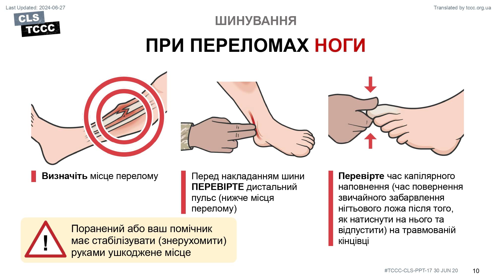 module-17-fractures-splinting-slide-10