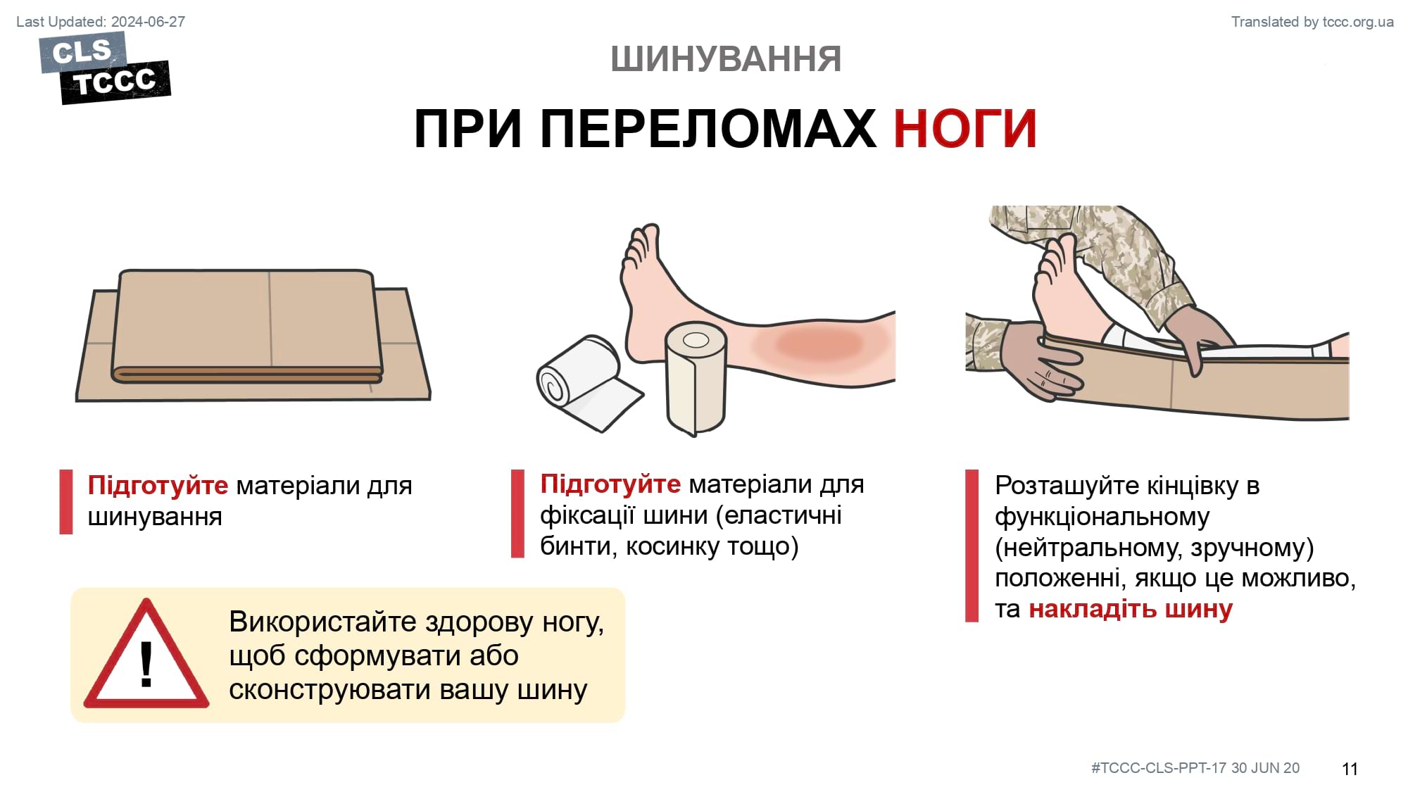 module-17-fractures-splinting-slide-11