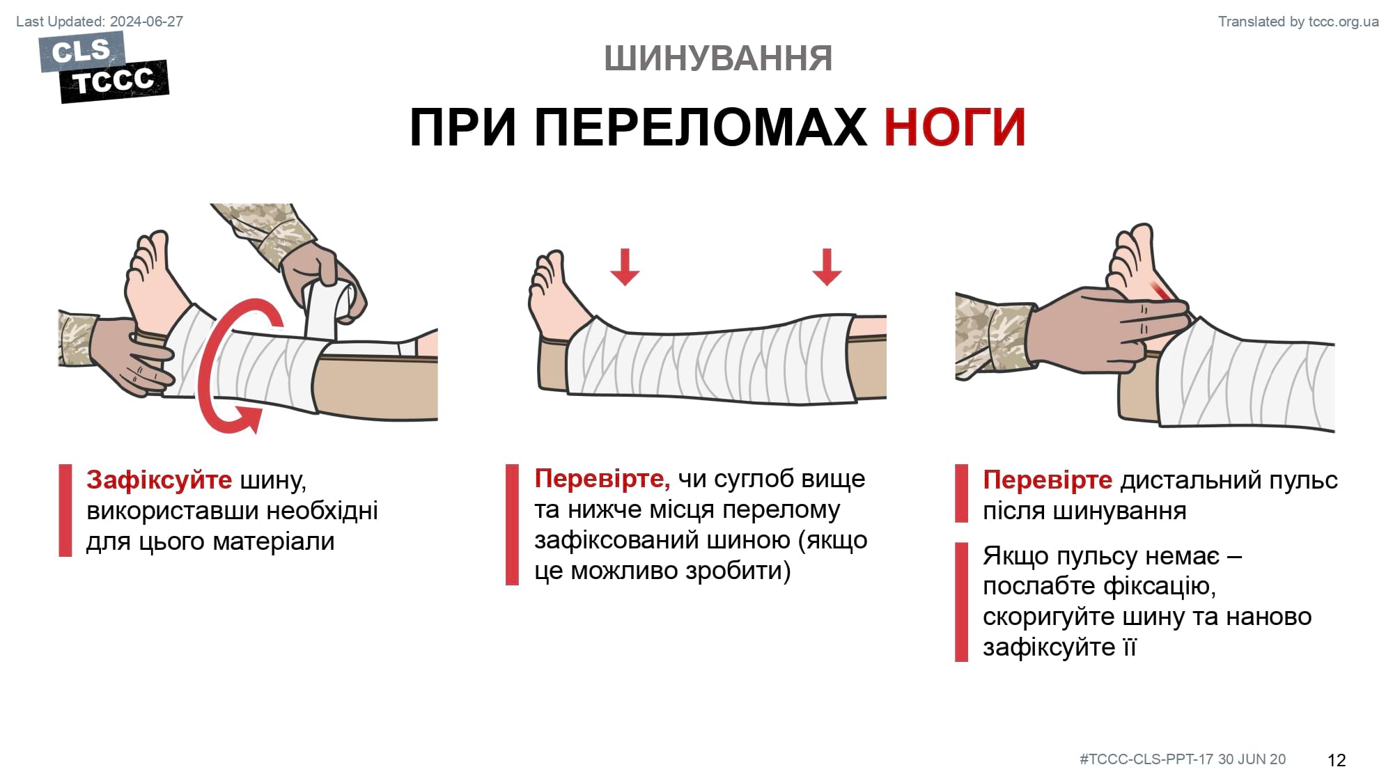 module-17-fractures-splinting-slide-12