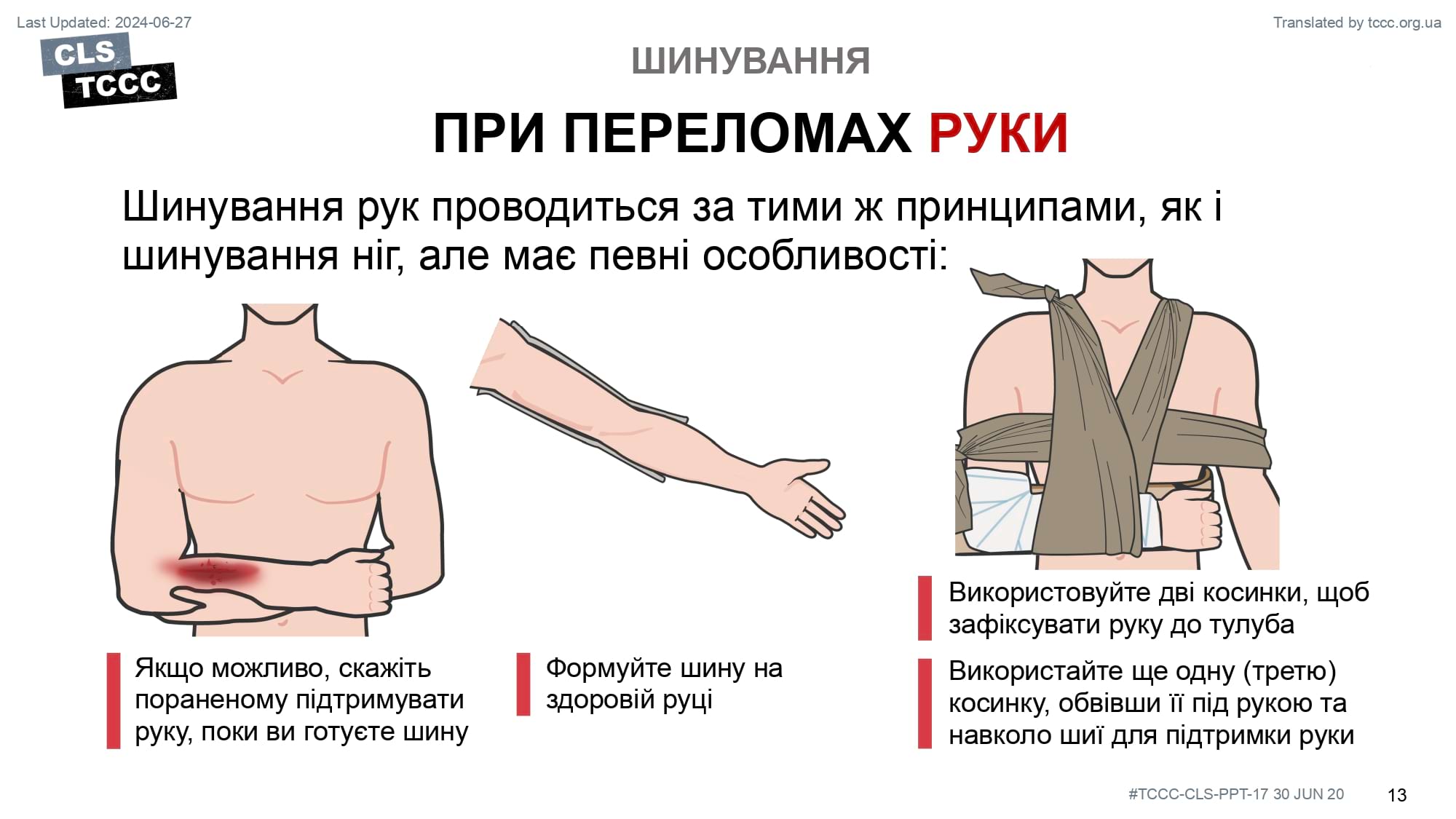 module-17-fractures-splinting-slide-13
