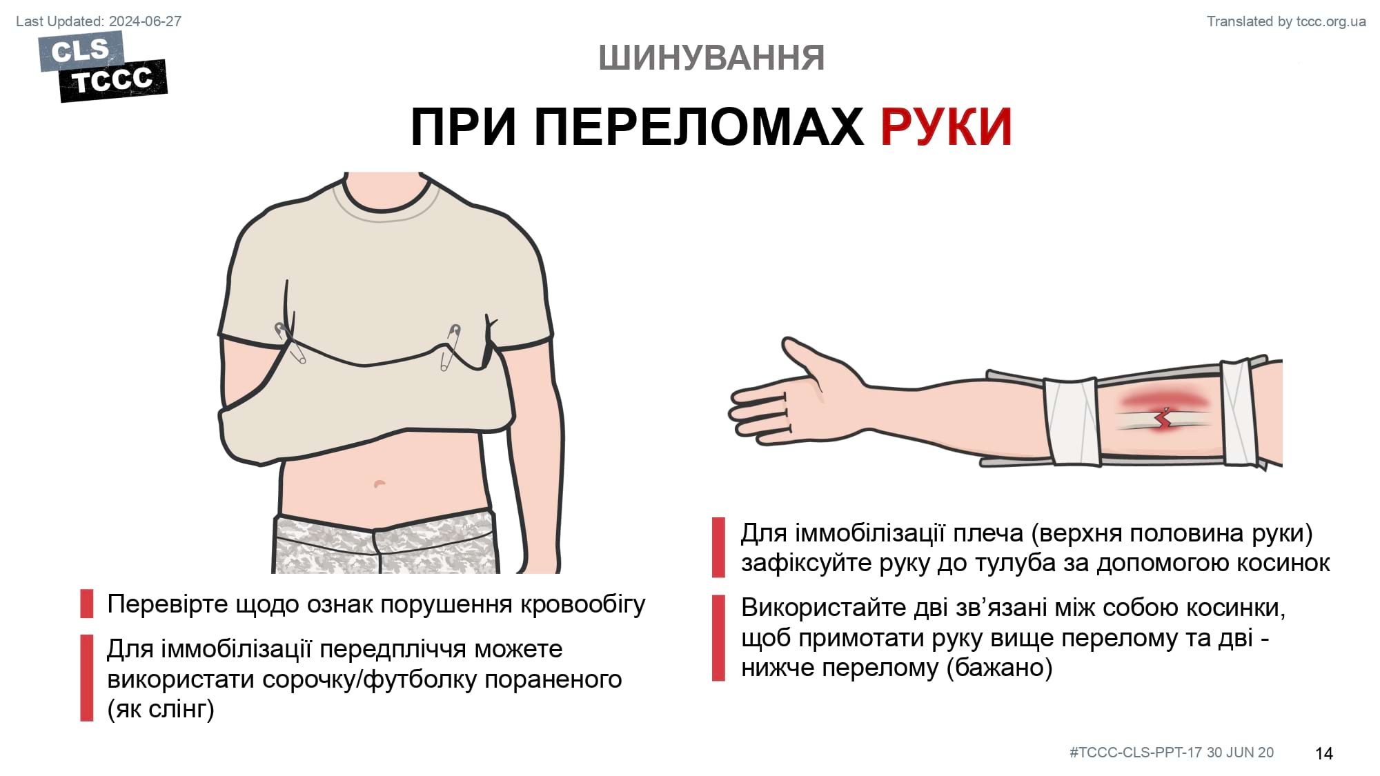 module-17-fractures-splinting-slide-14