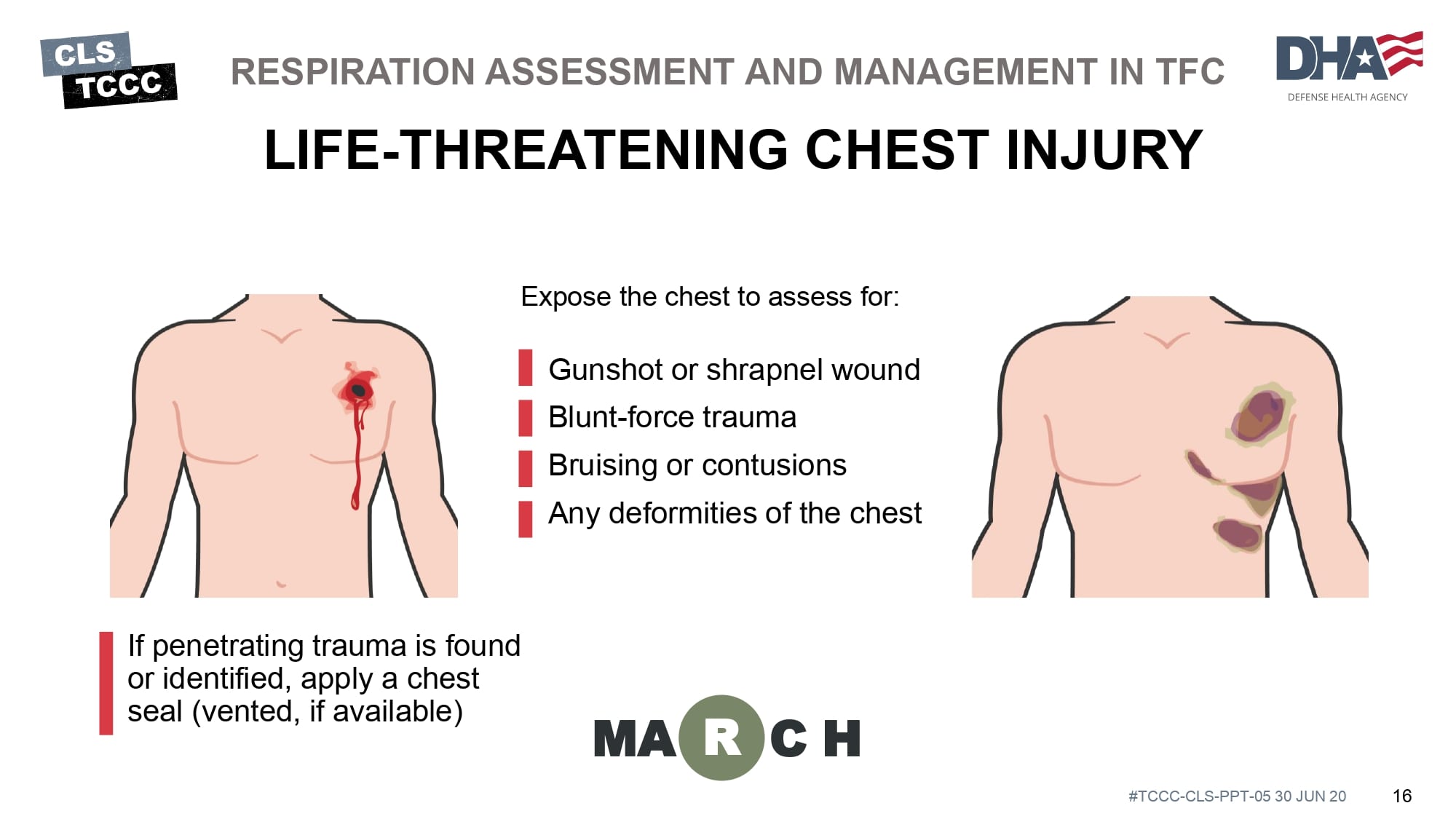 module-5-tactical-trauma-assessment-slide-16