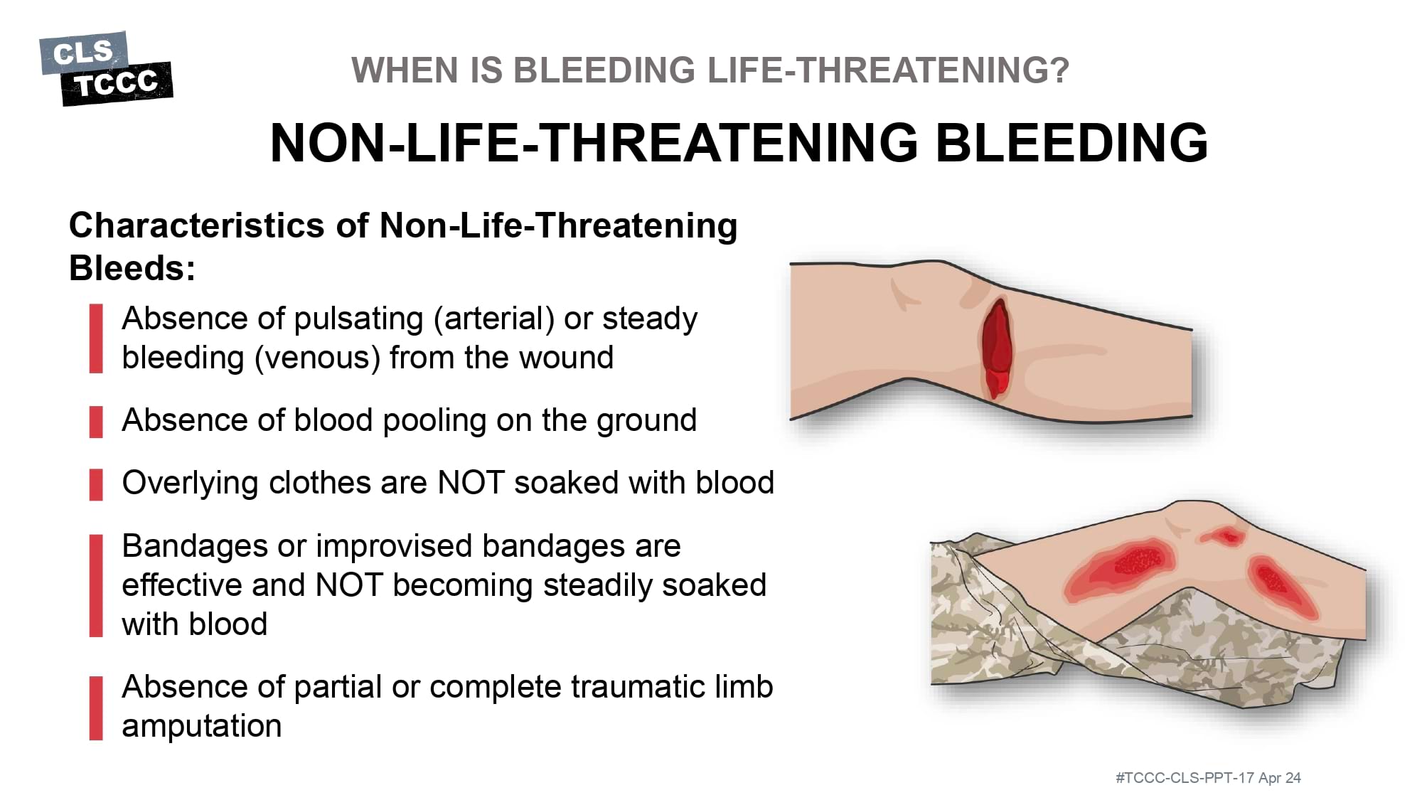 module-6-massive-hemorrhage-control-in-tfc-slide-13