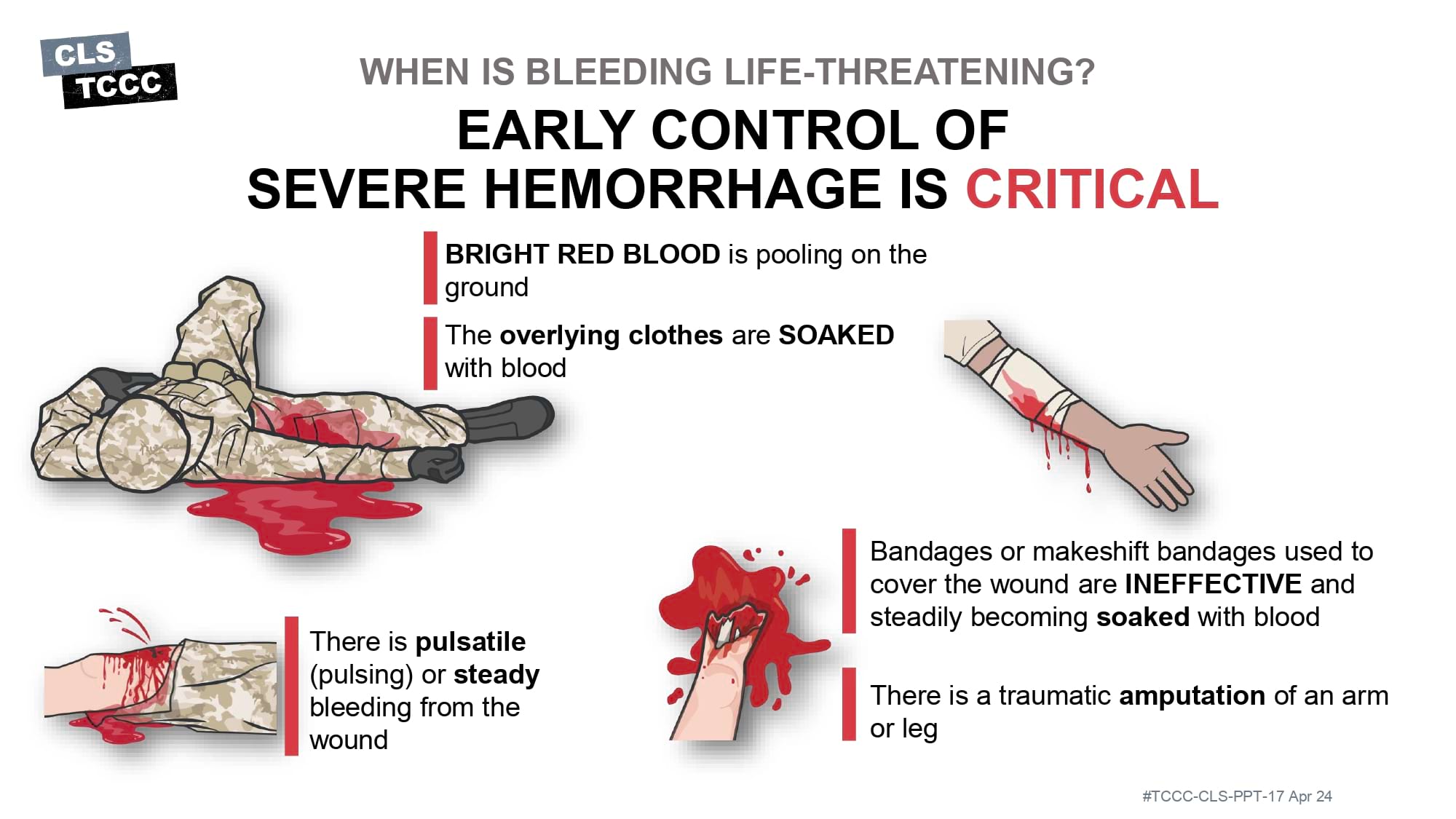 module-6-massive-hemorrhage-control-in-tfc-slide-14
