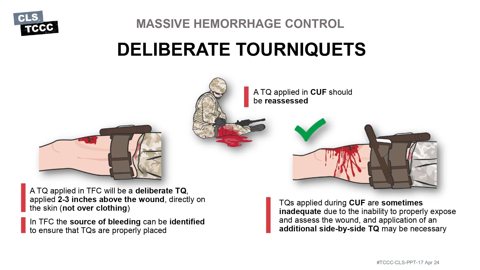 module-6-massive-hemorrhage-control-in-tfc-slide-19