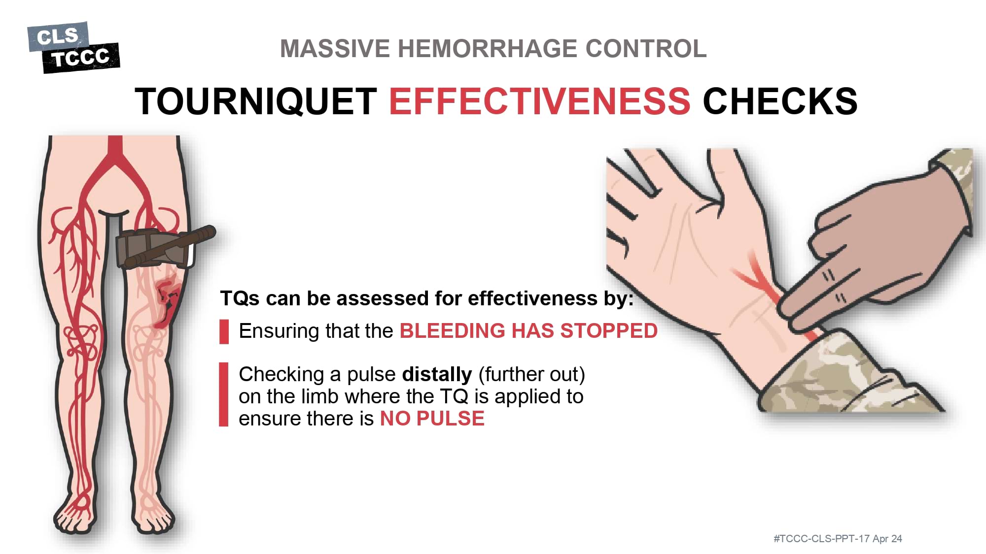 module-6-massive-hemorrhage-control-in-tfc-slide-21