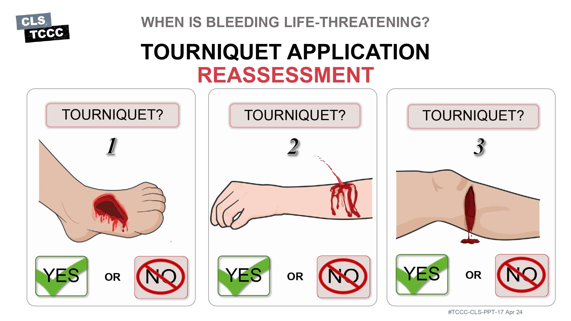 module-6-massive-hemorrhage-control-in-tfc-slide-26