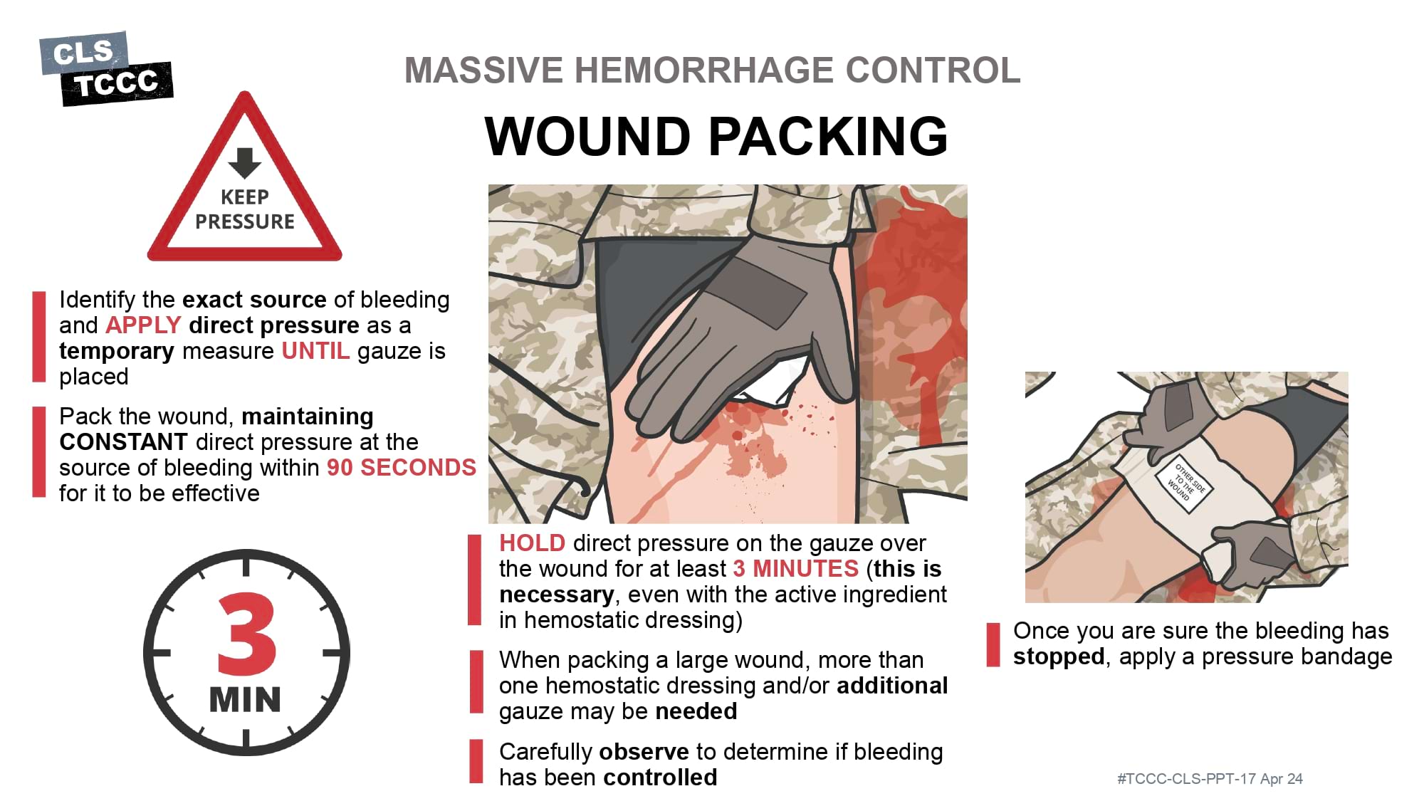module-6-massive-hemorrhage-control-in-tfc-slide-32