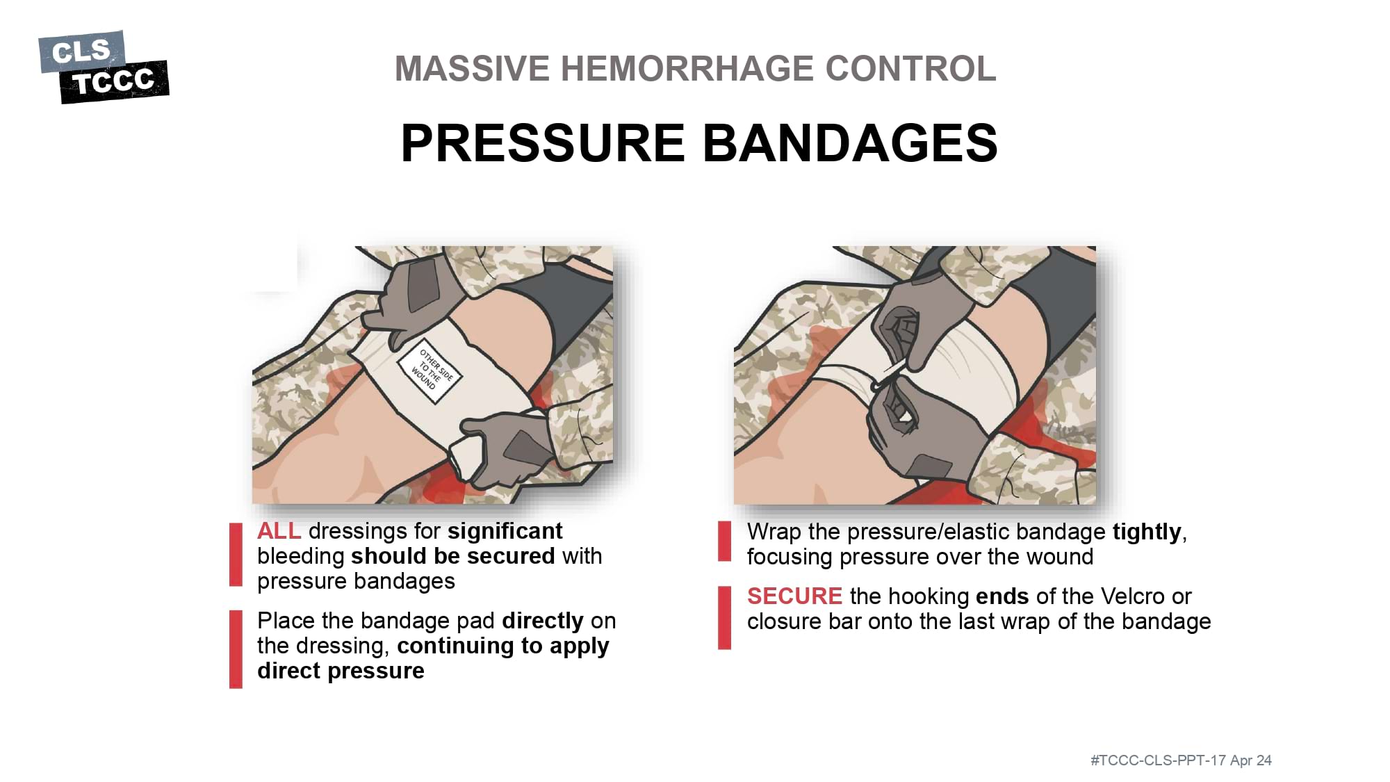 module-6-massive-hemorrhage-control-in-tfc-slide-34