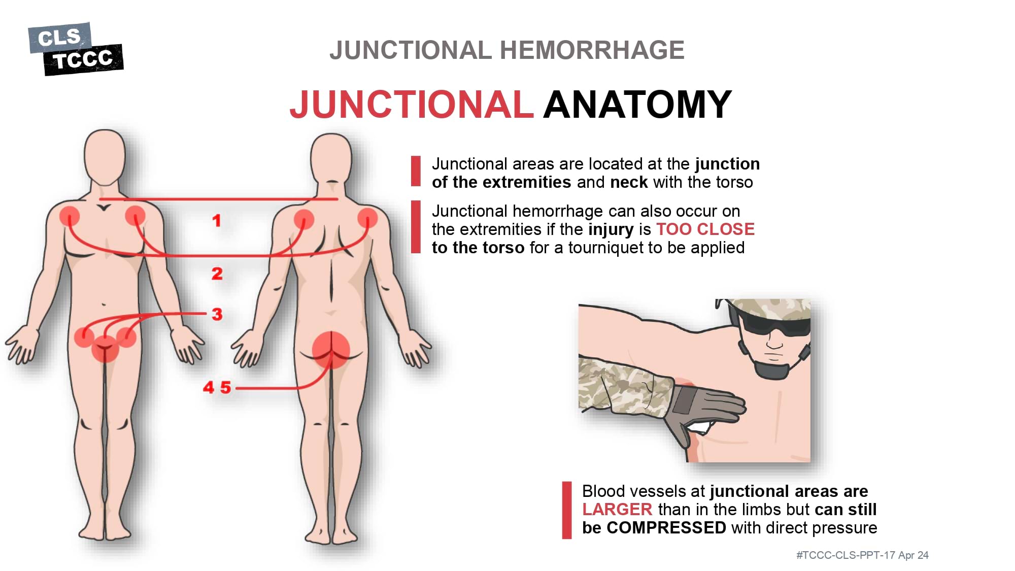 module-6-massive-hemorrhage-control-in-tfc-slide-37