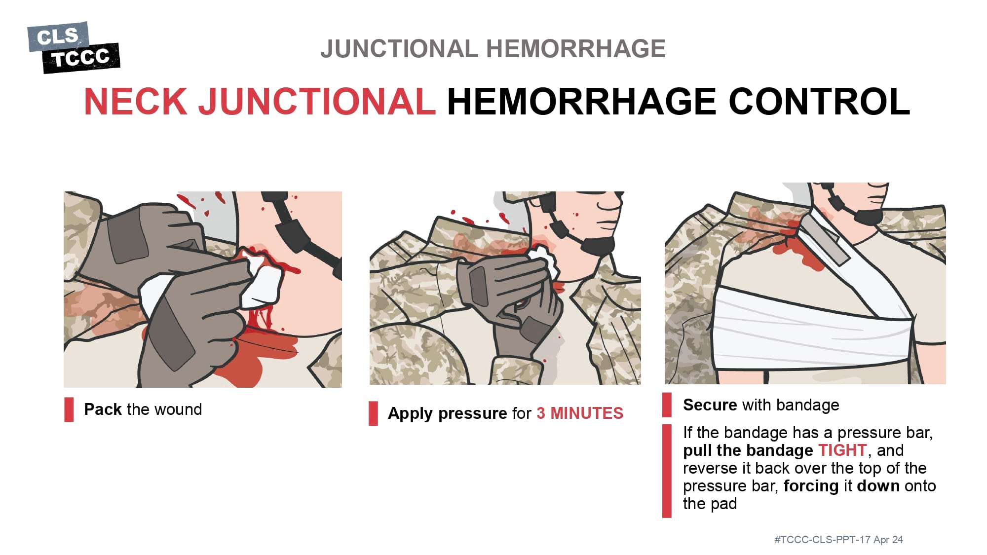 module-6-massive-hemorrhage-control-in-tfc-slide-38