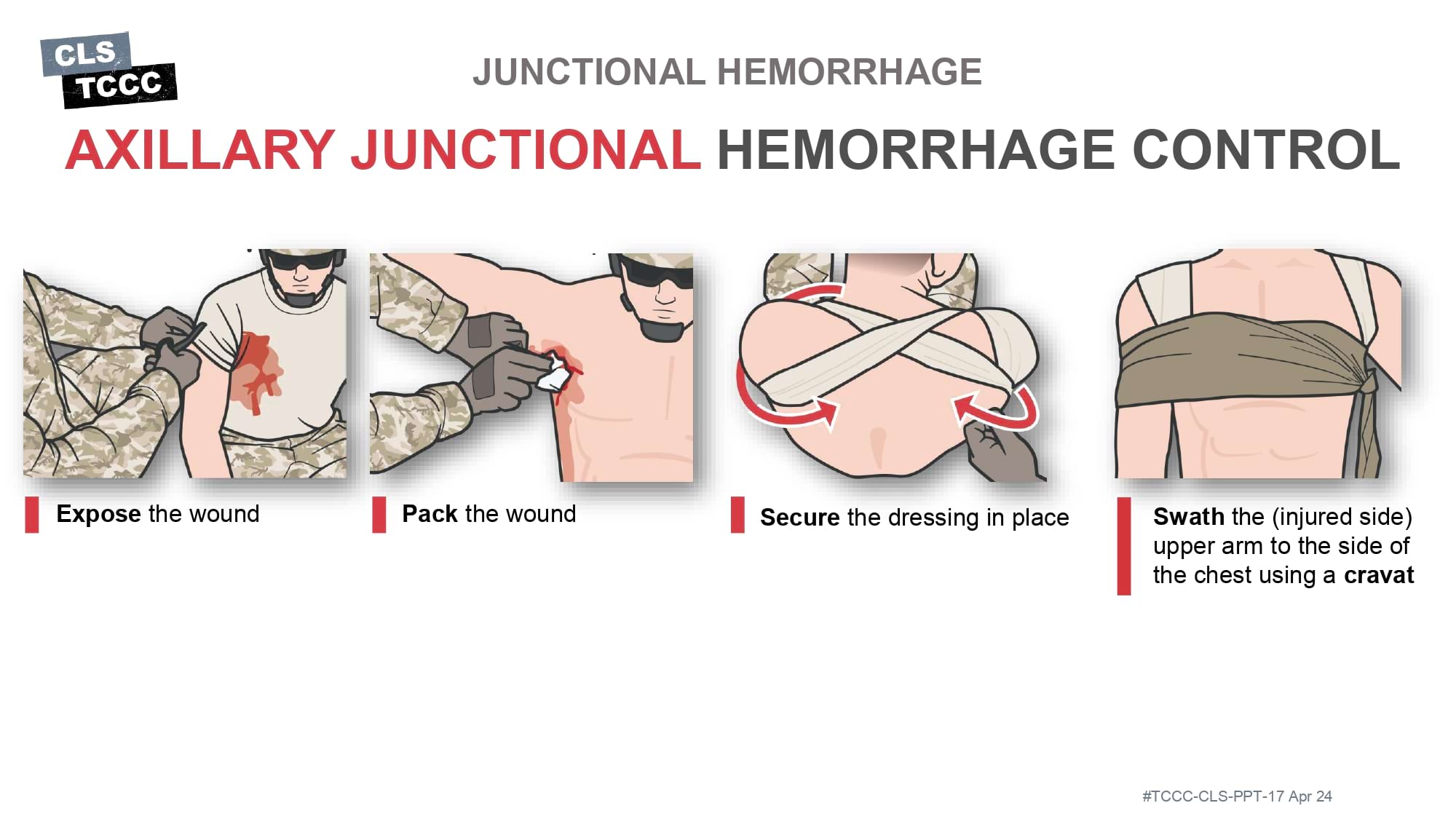 module-6-massive-hemorrhage-control-in-tfc-slide-40