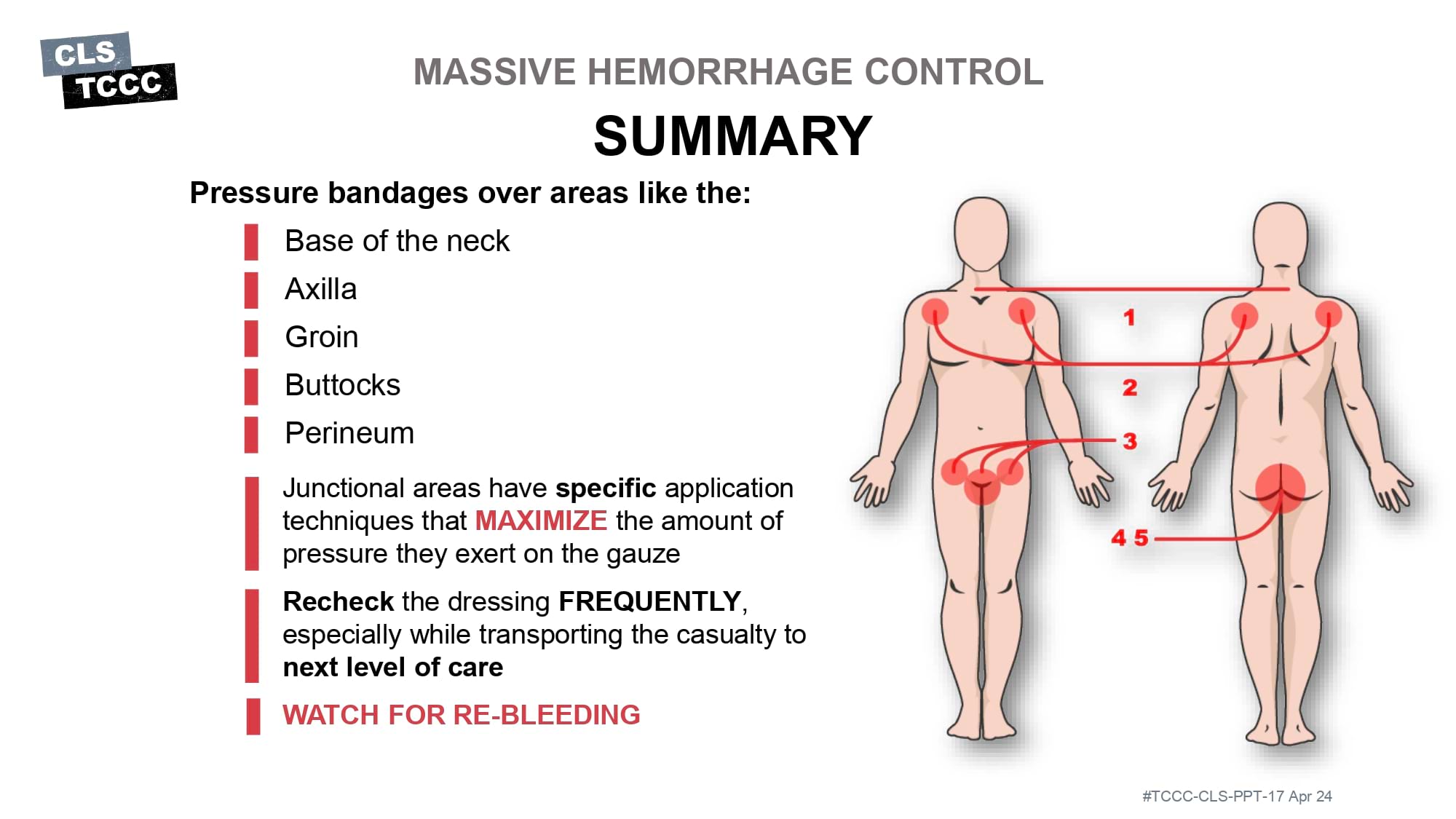 module-6-massive-hemorrhage-control-in-tfc-slide-45