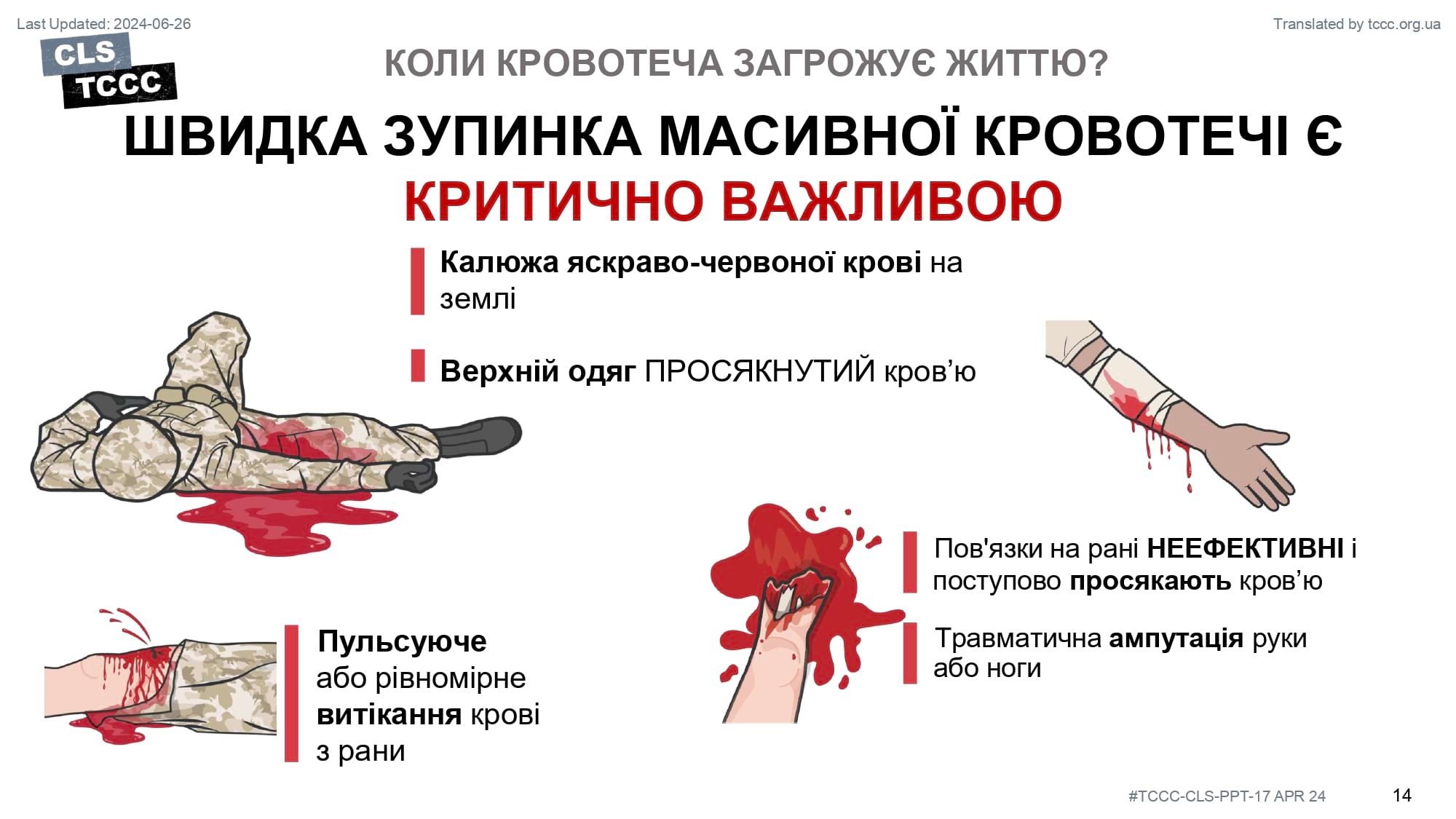 module-6-massive-hemorrhage-control-in-tfc-slide-14