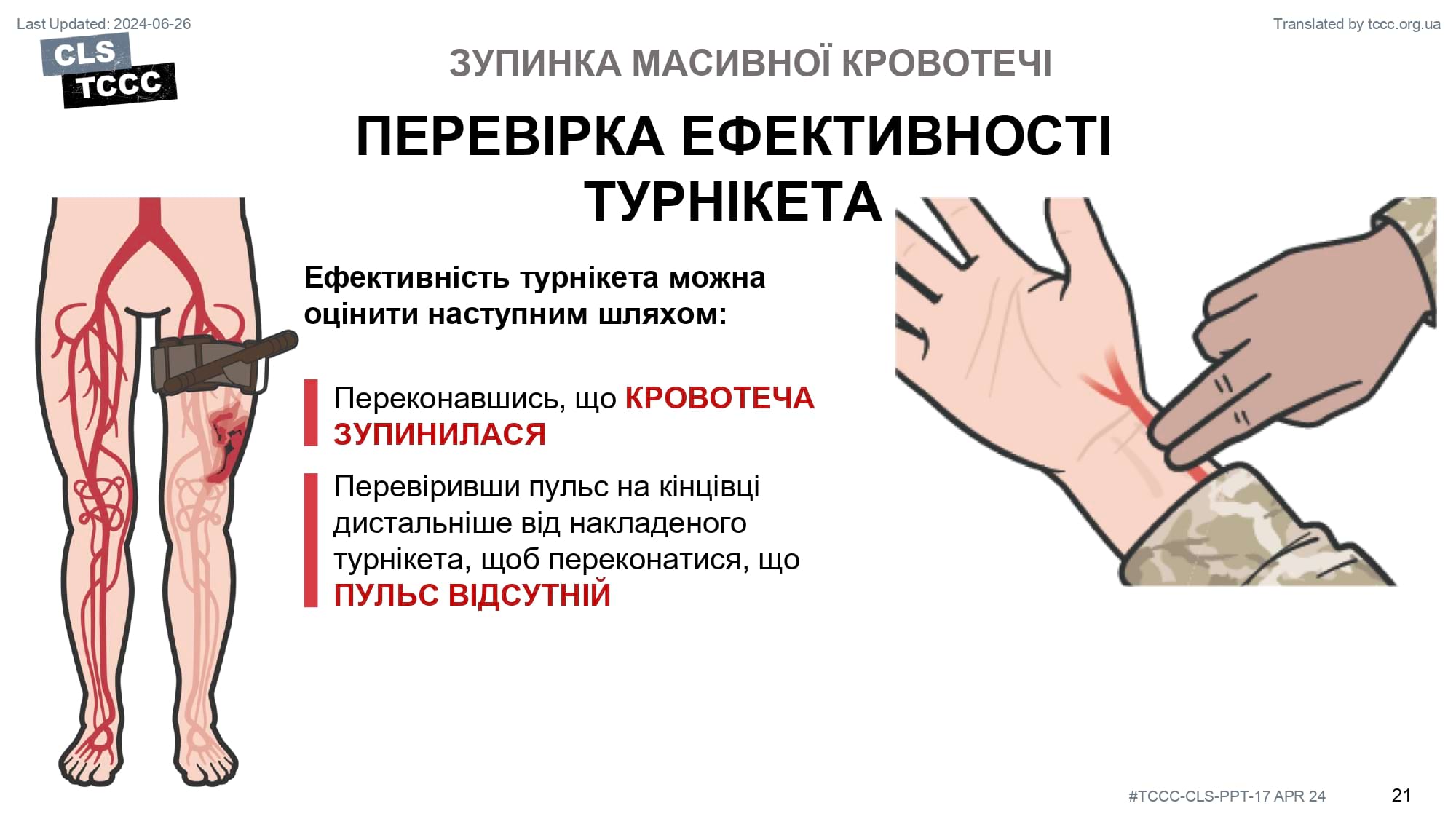 module-6-massive-hemorrhage-control-in-tfc-slide-21