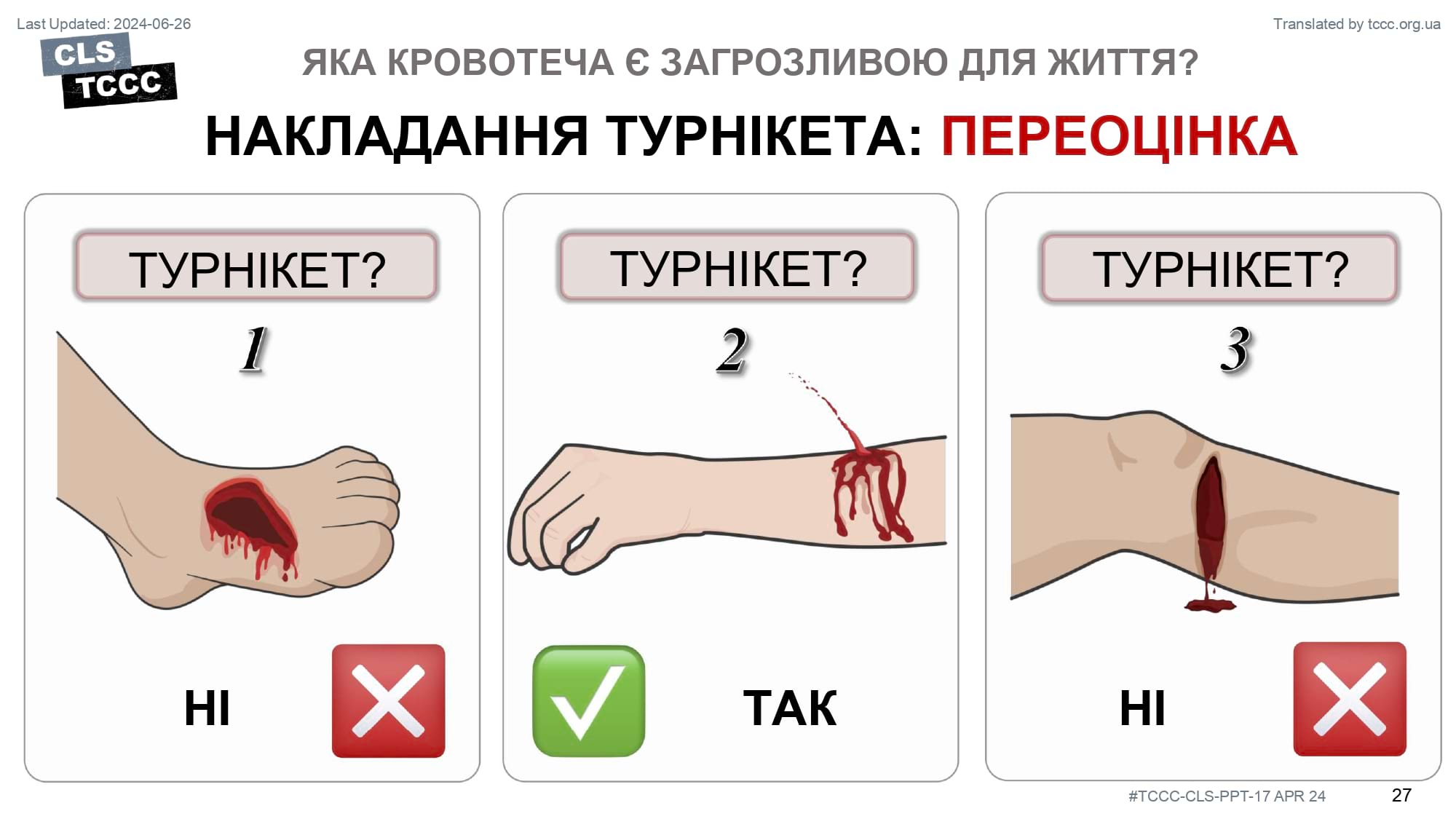 module-6-massive-hemorrhage-control-in-tfc-slide-27