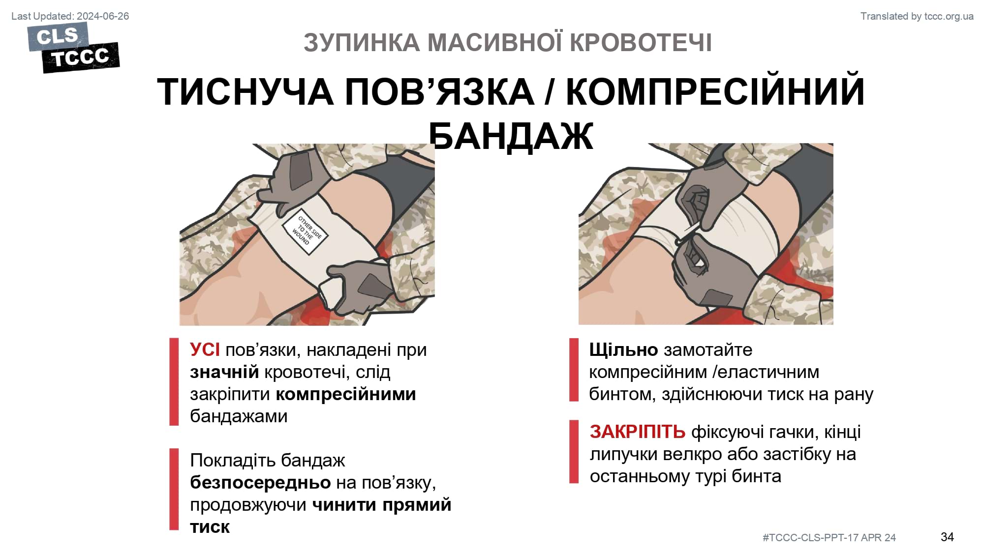 module-6-massive-hemorrhage-control-in-tfc-slide-34