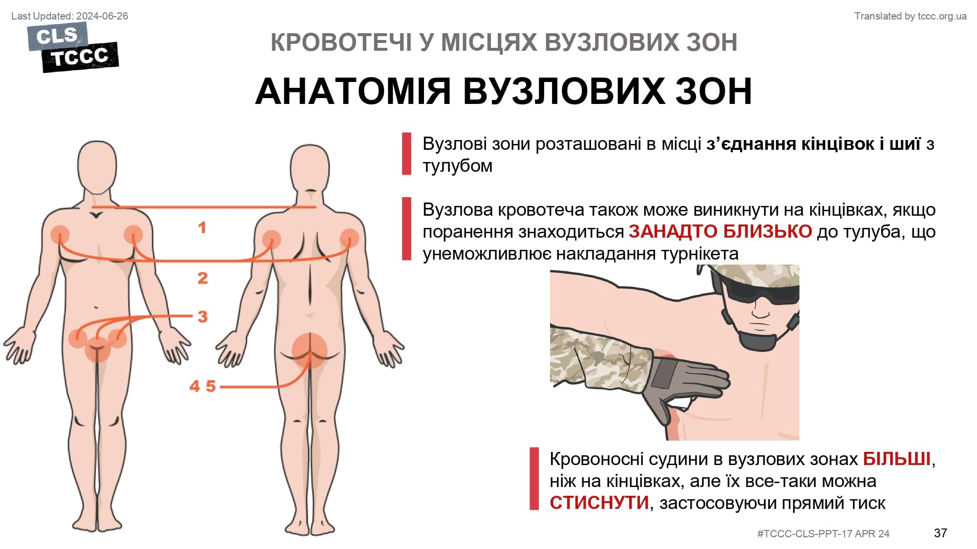 module-6-massive-hemorrhage-control-in-tfc-slide-37