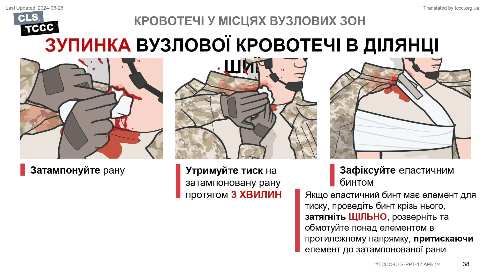 module-6-massive-hemorrhage-control-in-tfc-slide-38