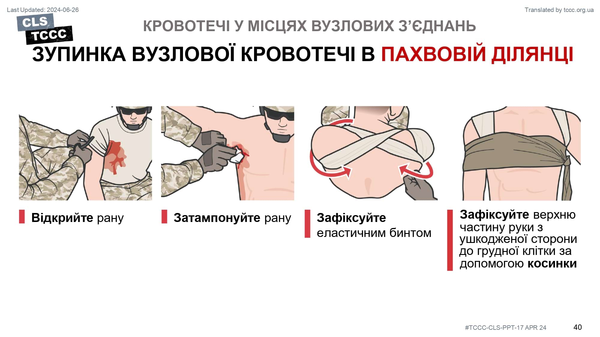 module-6-massive-hemorrhage-control-in-tfc-slide-40