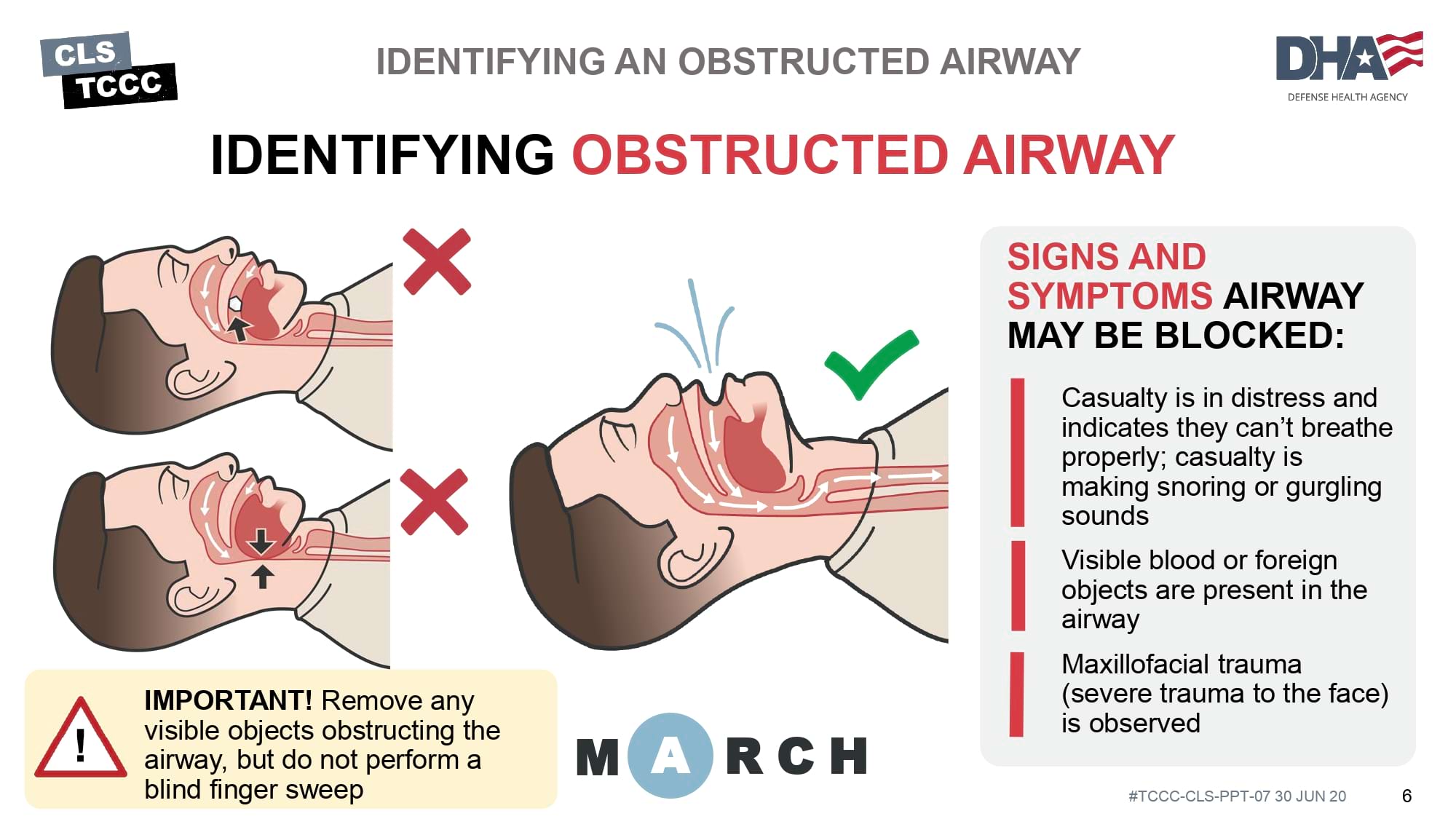 module-7-airway-management-in-tfc-cls-slide-06