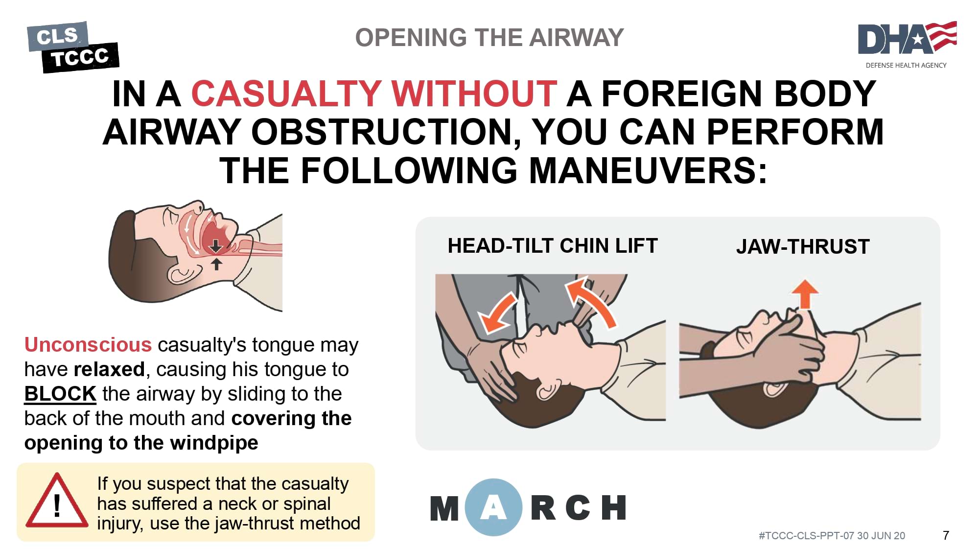 module-7-airway-management-in-tfc-cls-slide-07