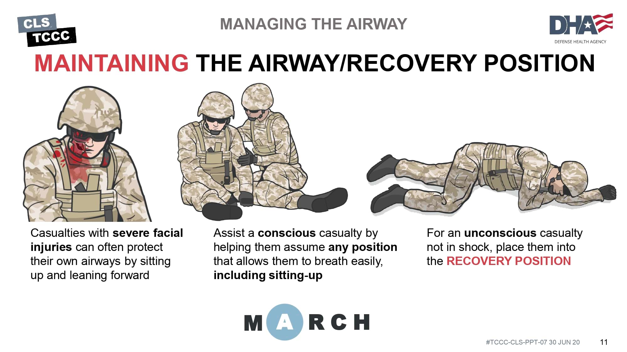 module-7-airway-management-in-tfc-cls-slide-11