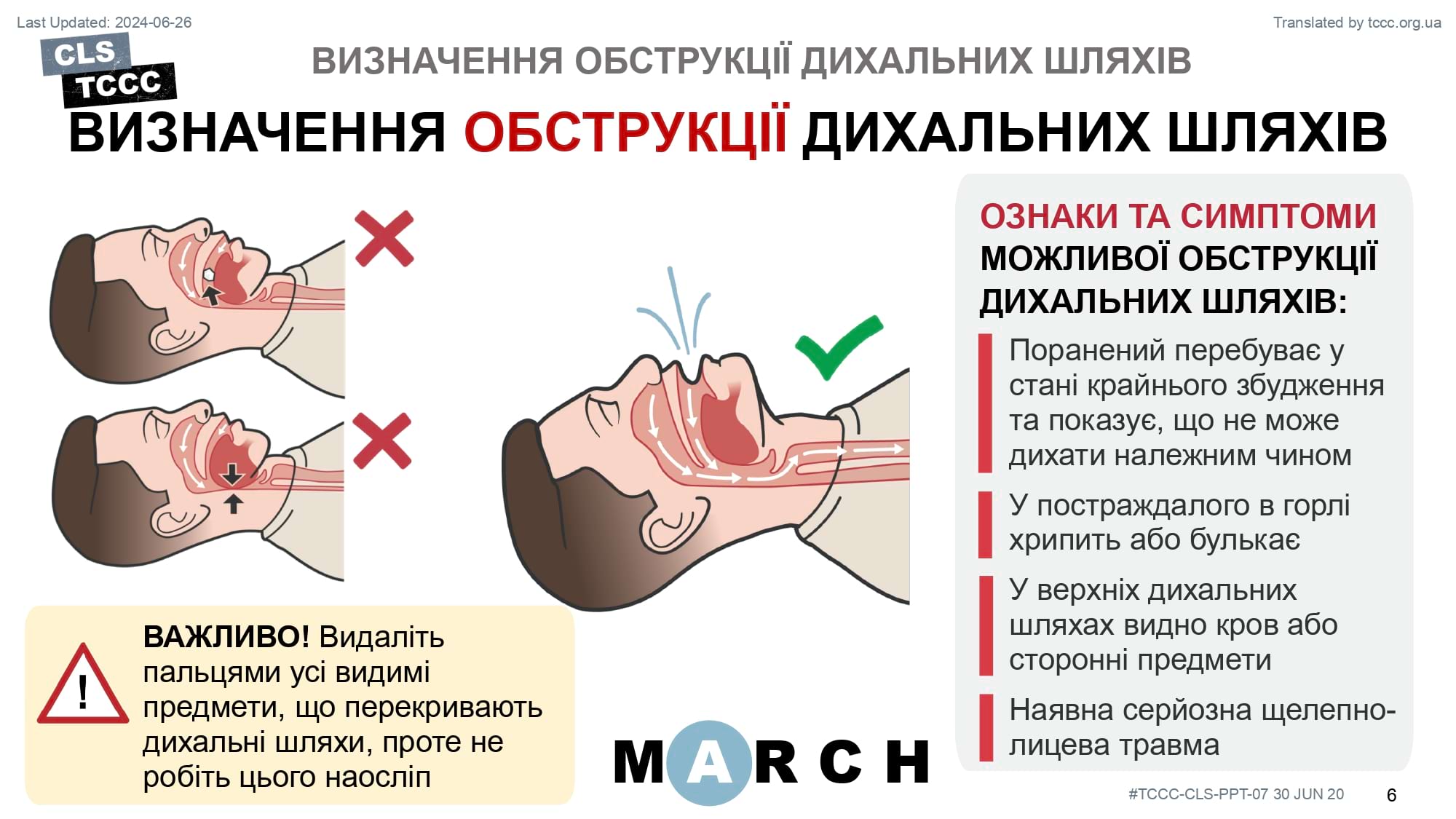 module-7-airway-management-in-tfc-cls-slide-06
