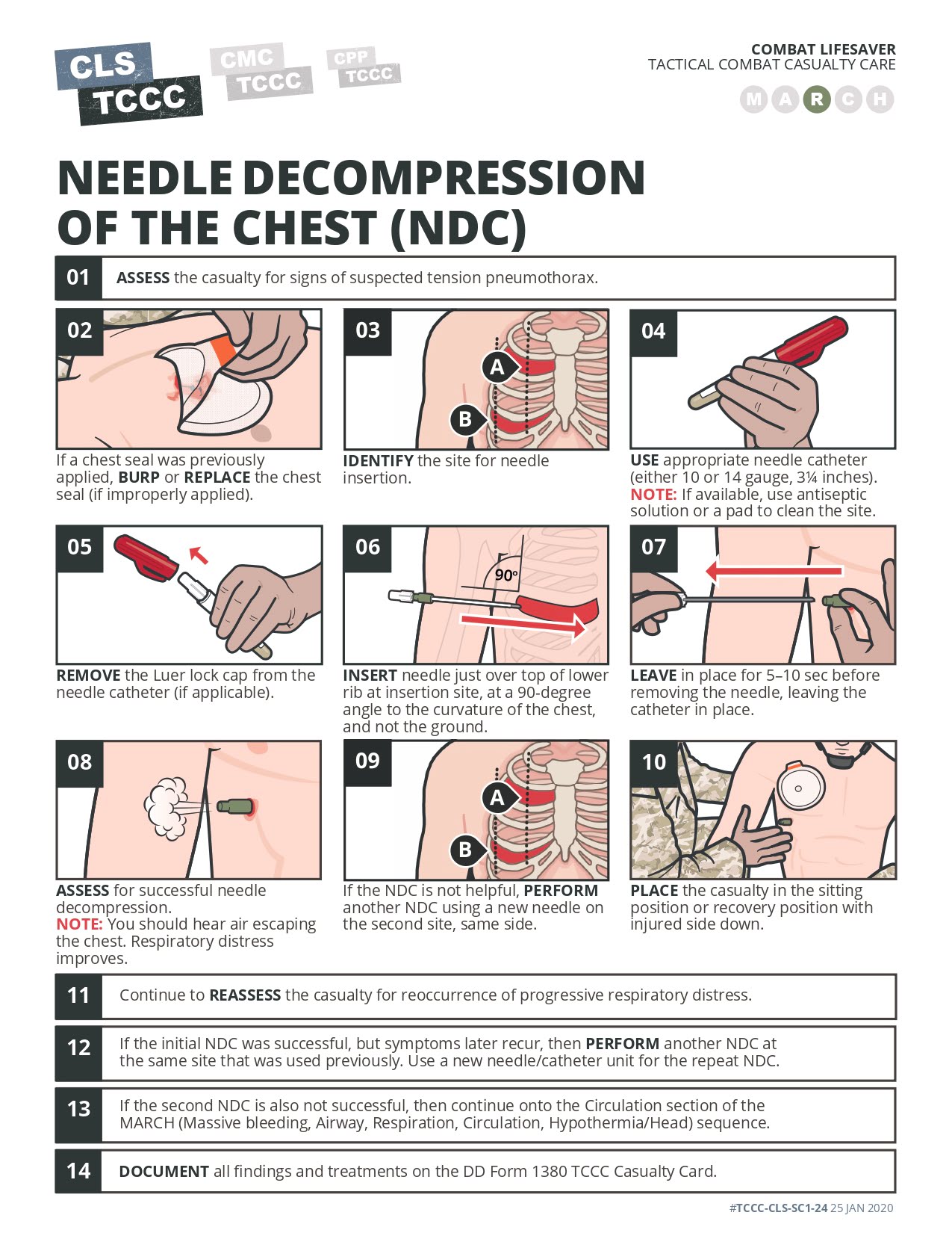 Needle decompression of the chest