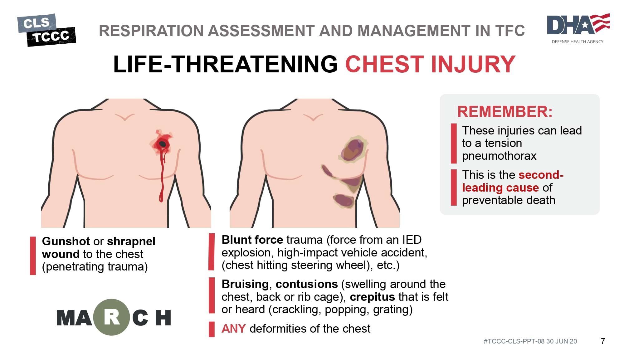 module-8-respiration-assessment-and-management-in-tfc-slide-07