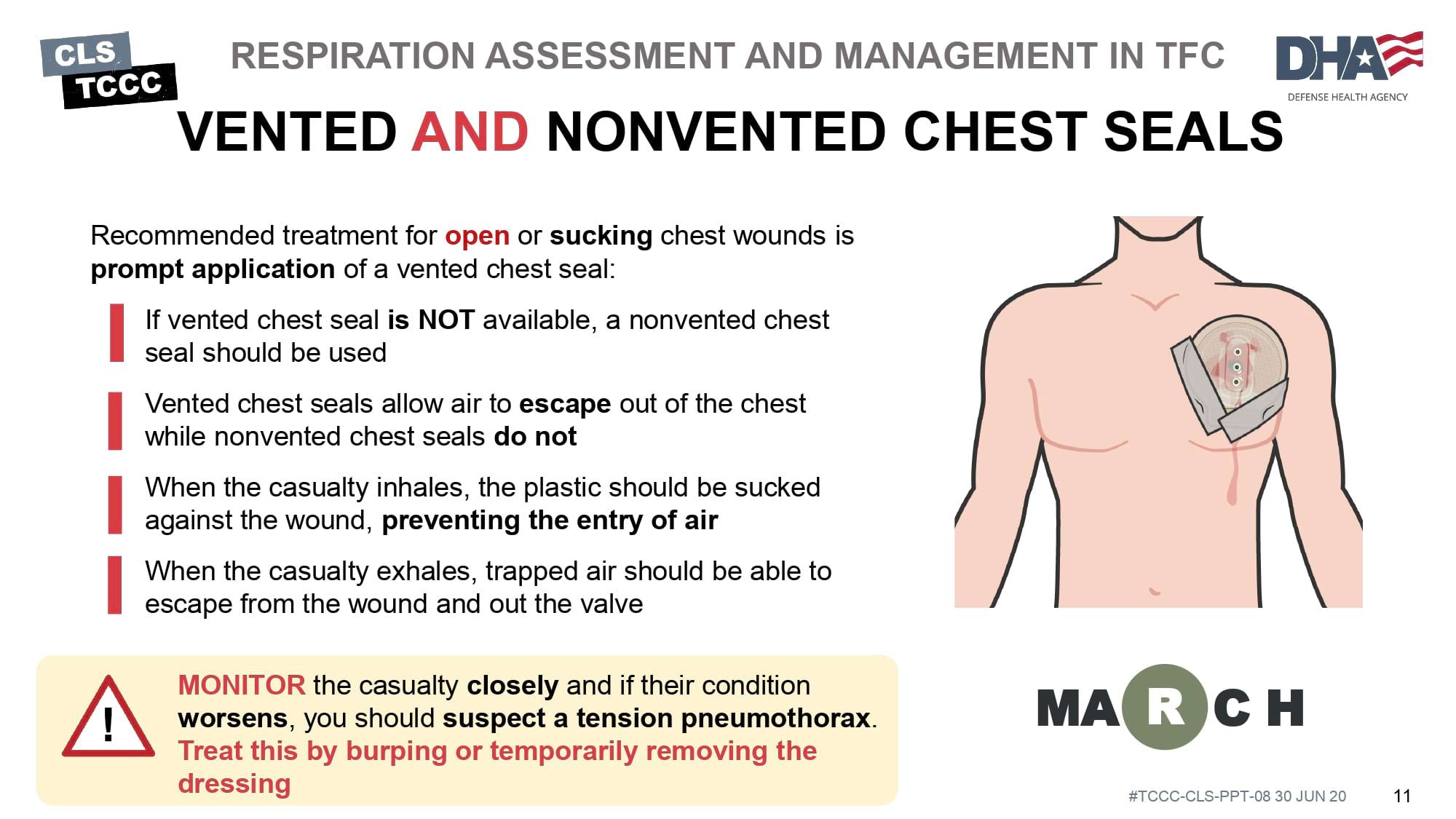 module-8-respiration-assessment-and-management-in-tfc-slide-11