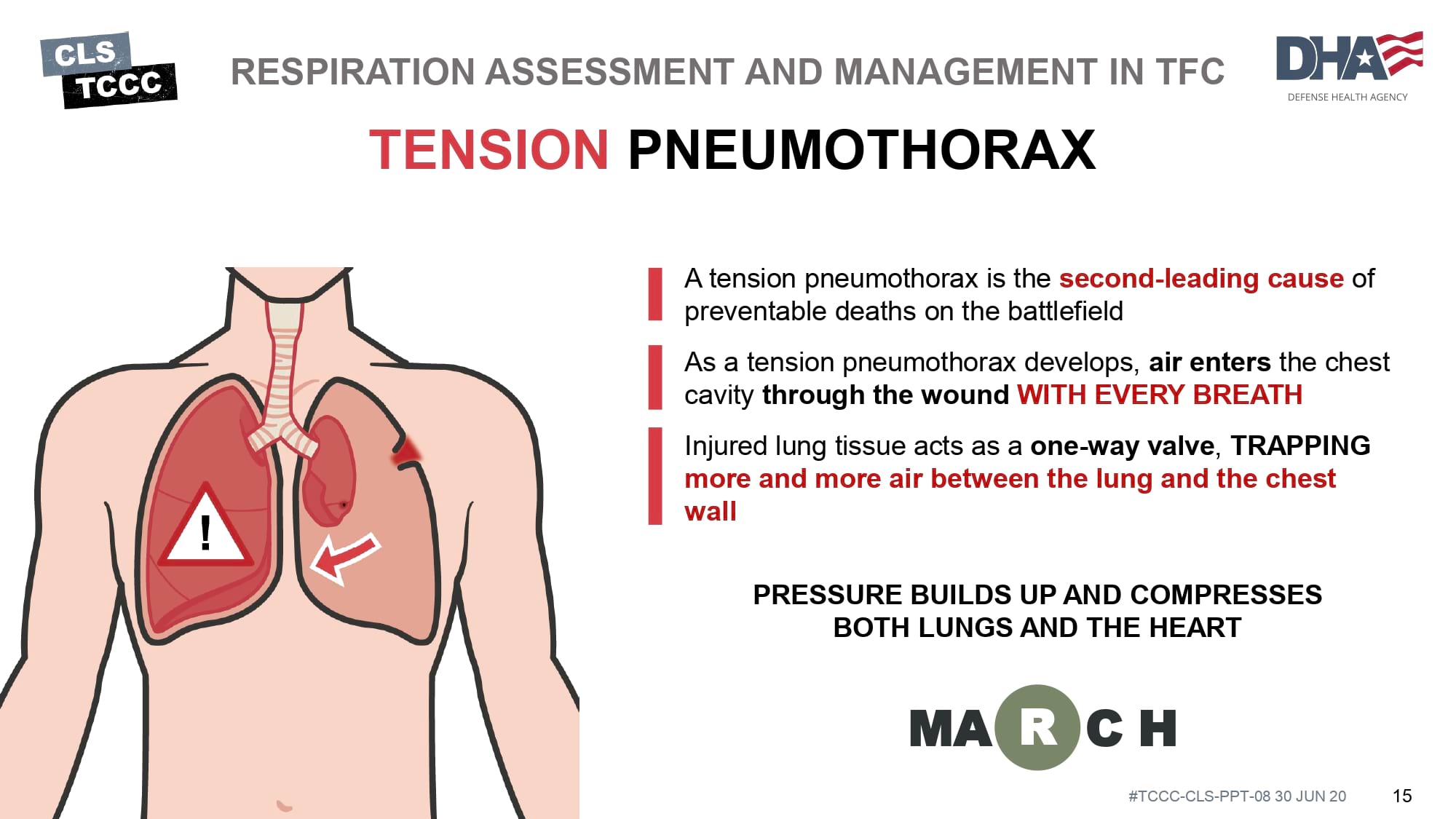 module-8-respiration-assessment-and-management-in-tfc-slide-15