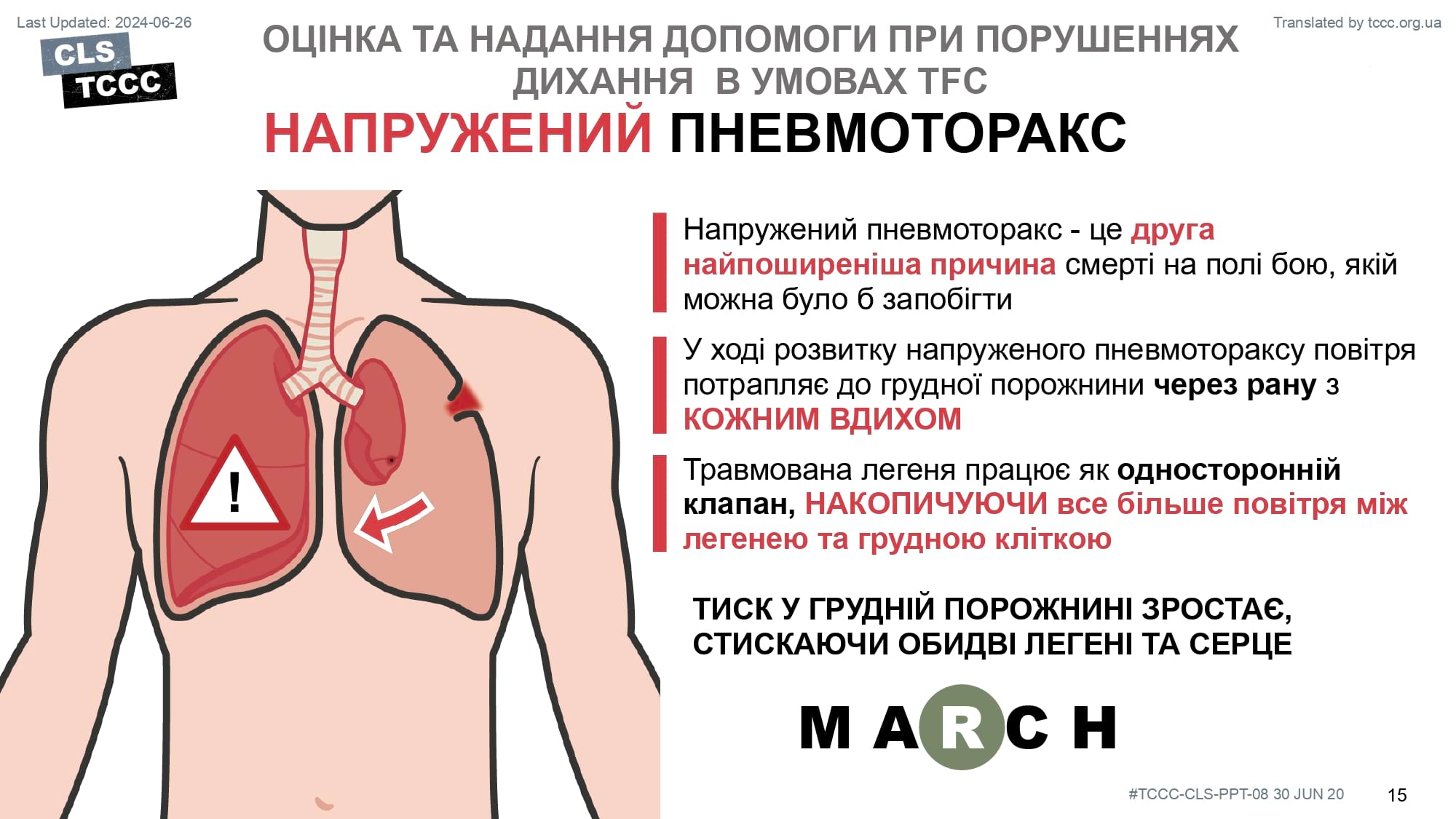 module-8-respiration-assessment-and-management-in-tfc-slide-15