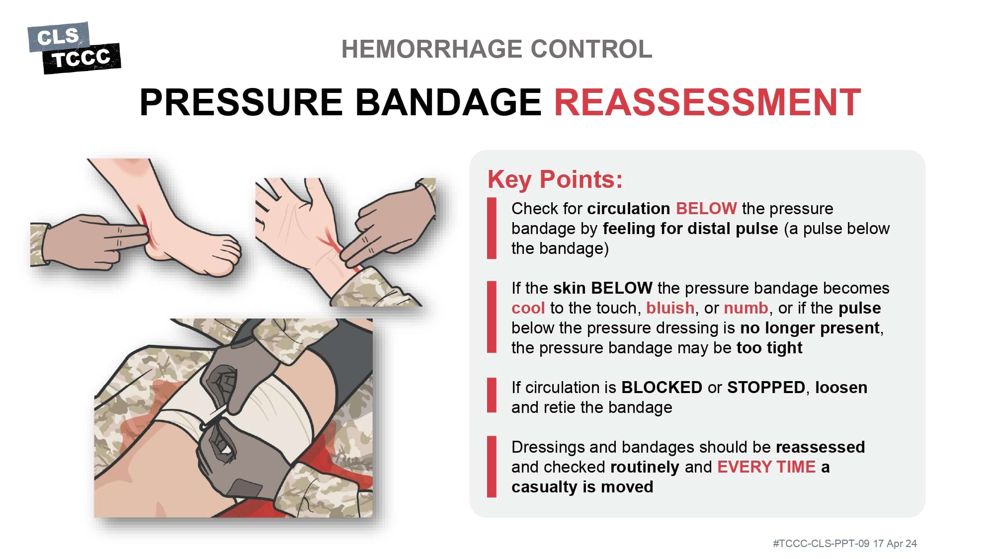 module-9-circulation-hemorrhage-control-in-tfc-slide-17