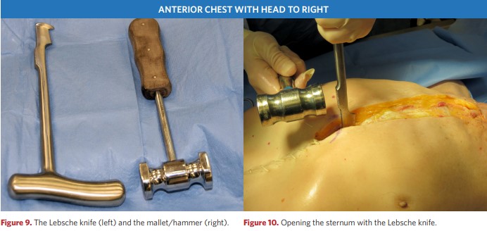 The Lebsche knife and the mallet/hammer