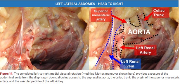 Medial rotation of internal organs