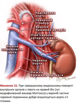 Modified Mattocks manoeuvre - anatomy