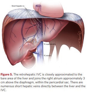 The retrohepatic IVC