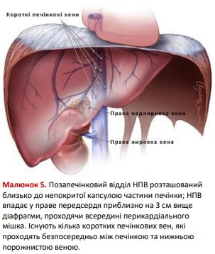 Позапечінковий відділ НПВ