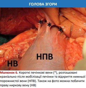 Short hepatic veins