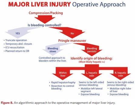 An algorithmic approach to the operative management of major liver injury