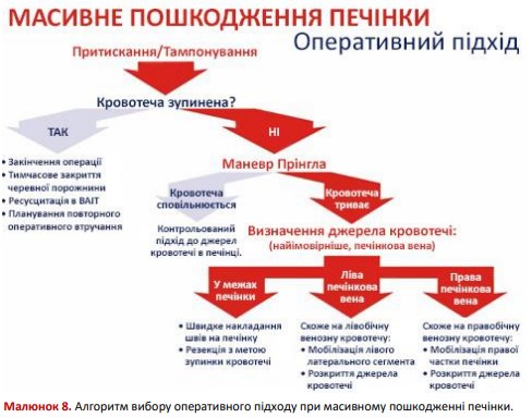 Алгоритм вибору оперативного підходу при масивному пошкодженні печінки