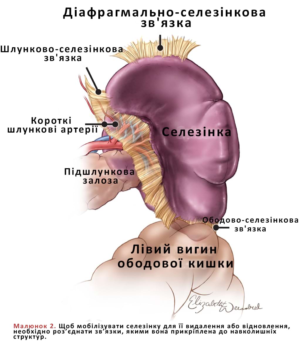 Щоб мобілізувати селезінку для її видалення або відновлення, необхідно роз’єднати зв’язки, якими вона прикріплена до навколишніх структур.