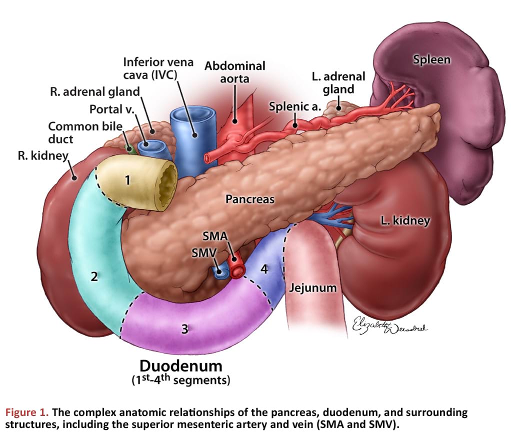 The complex anatomic relationships of the pancreas, duodenum, and surrounding structures, including the superior mesenteric artery and vein