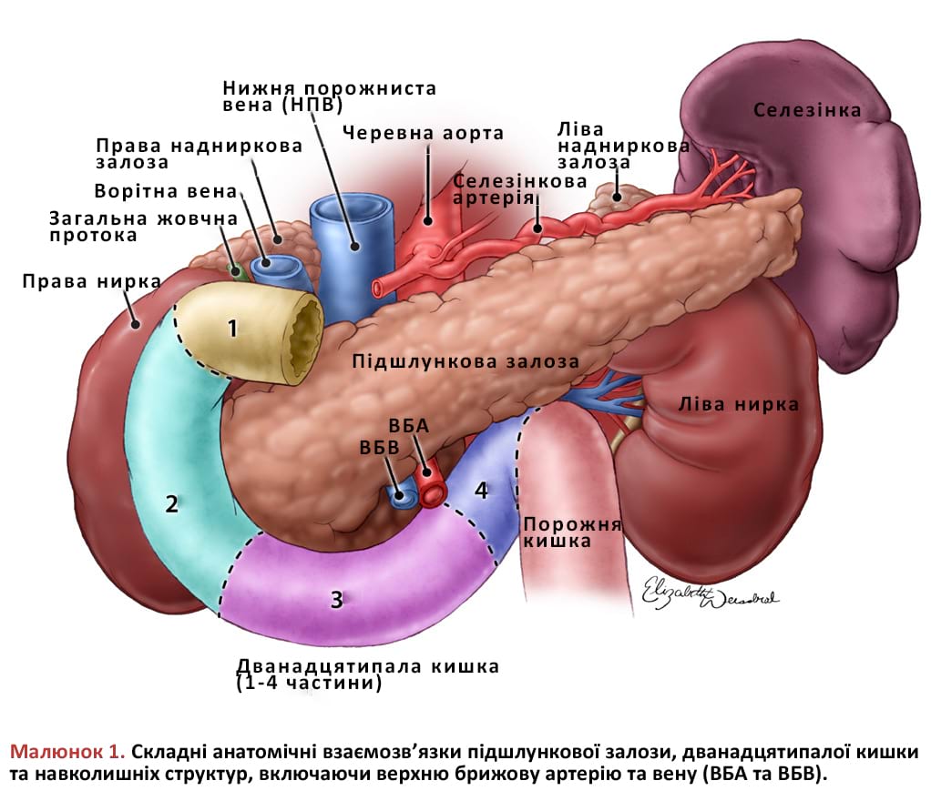 Складні анатомічні взаємозв’язки підшлункової залози, дванадцятипалої кишки та навколишніх структур, включаючи верхню брижову артерію та вену